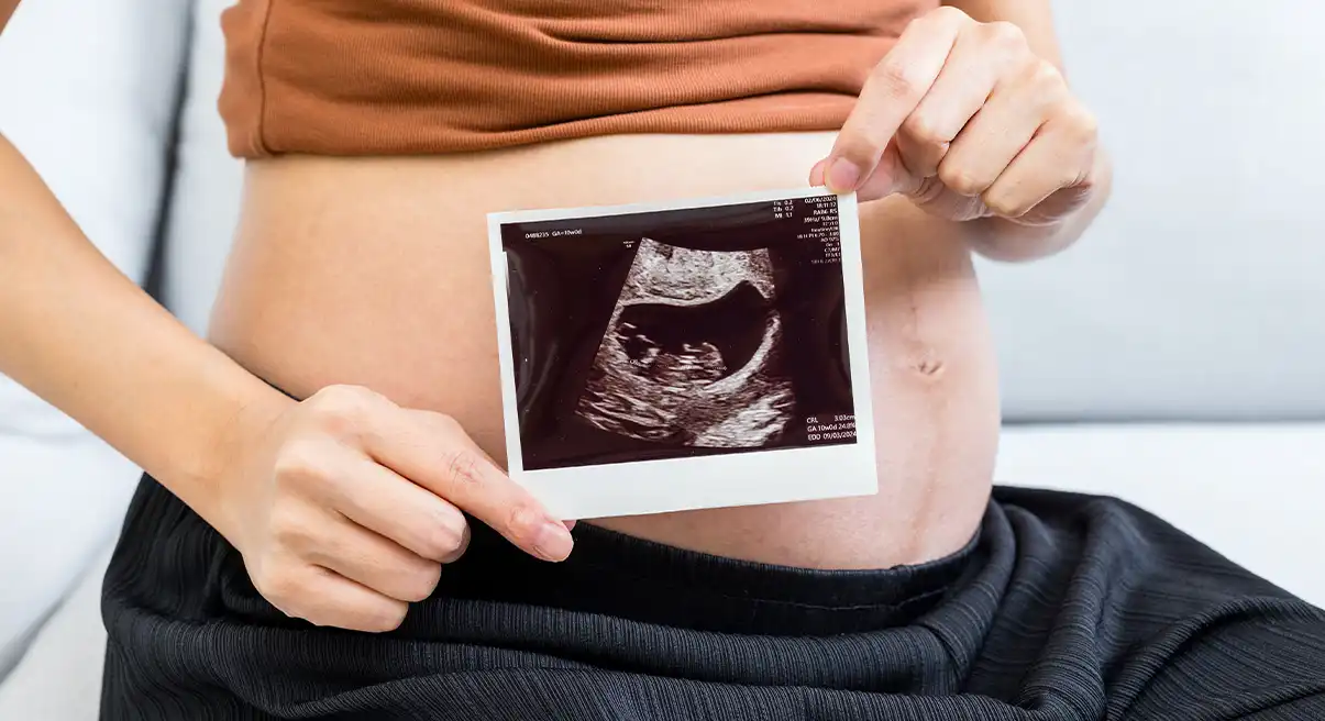 Pregnant hold with ultrasound baby photo